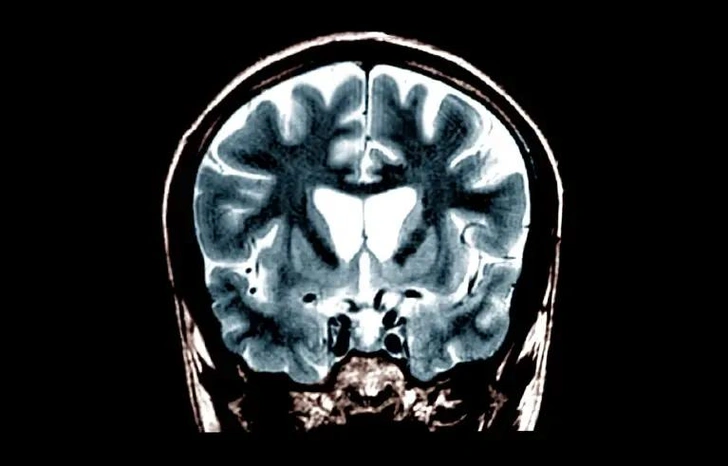 Даст годы независимой жизни. Генная терапия пришла на помощь больным с наследственным заболеванием головного мозга